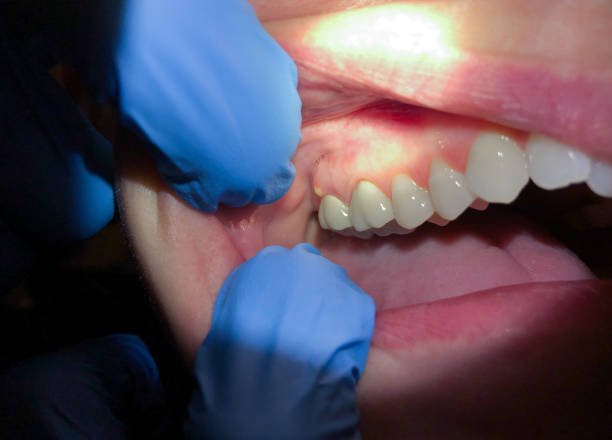 Best Emergency Dentist for Knocked-Out Tooth in Keystone Heights, FL